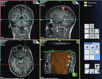 Voir le cerveau penser